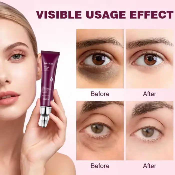 Crème Contour des Yeux Anti-Rides Instantanée : Estompe les Ridules, Raffermit et Atténue les Poches, Hydratante et Tonifiante