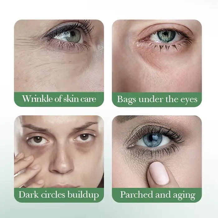 Centella Asiatica crème pour les yeux Anti cernes sous