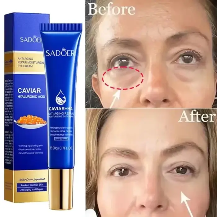 Crème anti-caviar pour les yeux