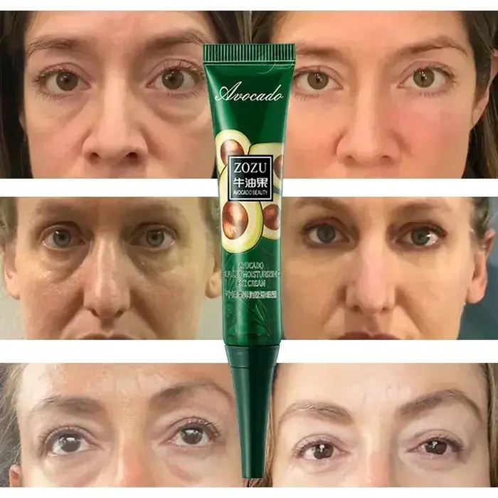Crème pour les yeux, élimine les cernes