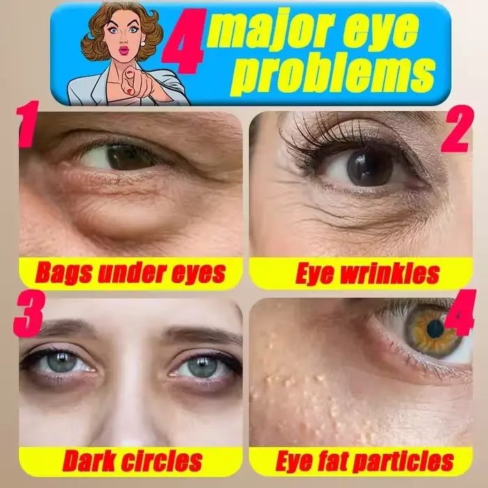 Crème pour les yeux contre les cernes et les poches